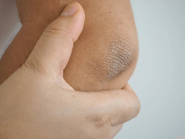 Dark Spot Whitening Cream