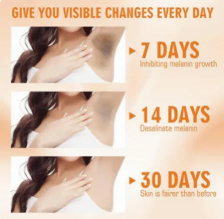 Dark Spot Whitening Cream